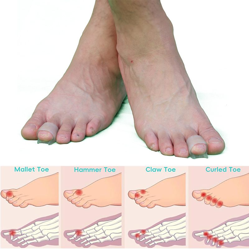 Pexmen 2/4Pcs Gel Hammer Toe C - огляд і ціна Power Tools Hammer
